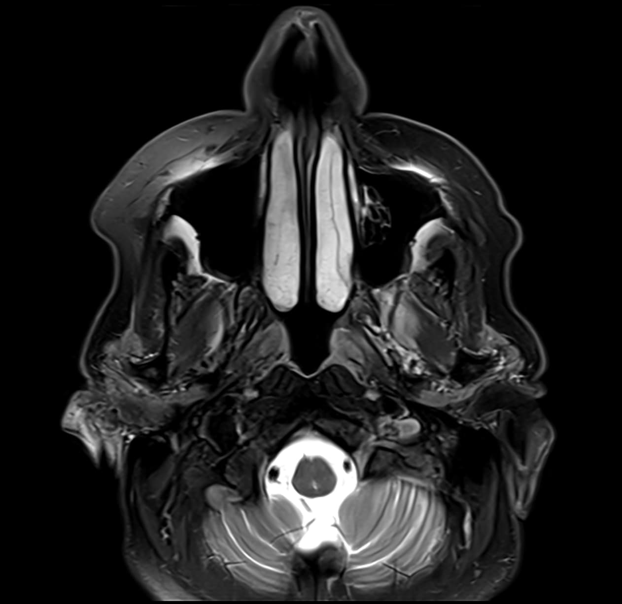 Cross-sectional head and neck imaging